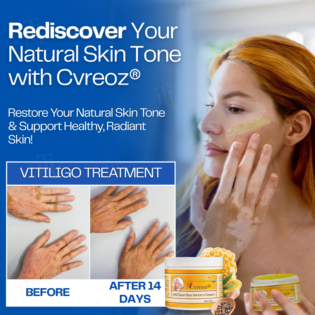 LAST 44 PCS LEFT!! Cvreoz® VitiClear Bee Venom Cream