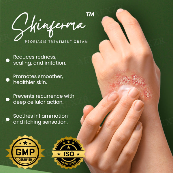 Skinferma™ Psoriasis Treatment Cream (𝟟𝟘% 𝕆𝔽𝔽 𝗘𝗡𝗗𝗦 𝗜𝗡 𝟭𝟬 𝗠𝗜𝗡𝗨𝗧𝗘𝗦)