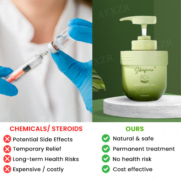 Skinferma™ Psoriasis Treatment Cream (𝟟𝟘% 𝕆𝔽𝔽 𝗘𝗡𝗗𝗦 𝗜𝗡 𝟭𝟬 𝗠𝗜𝗡𝗨𝗧𝗘𝗦)