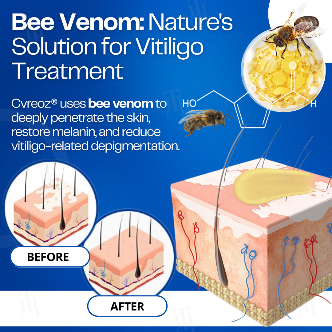 LAST 44 PCS LEFT!! Cvreoz® VitiClear Bee Venom Cream