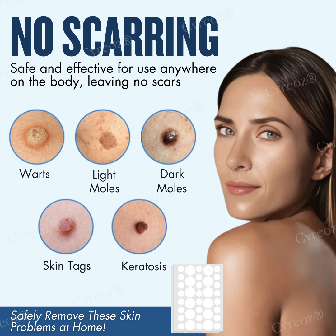 Cvreoz® Moles & Warts Removing Skin Tag Patch (𝟟𝟘% 𝕆𝔽𝔽 𝗘𝗡𝗗𝗦 𝗜𝗡 𝟭𝟬 𝗠𝗜𝗡𝗨𝗧𝗘𝗦)