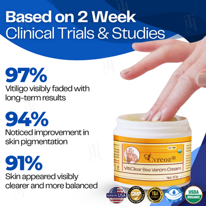 Cvreoz® VitiClear Bee Venom Cream  (𝟟𝟘% 𝕆𝔽𝔽 𝗘𝗡𝗗𝗦 𝗜𝗡 𝟭𝟬 𝗠𝗜𝗡𝗨𝗧𝗘𝗦)